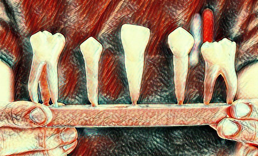 diş kökü iltihabı tedavisi