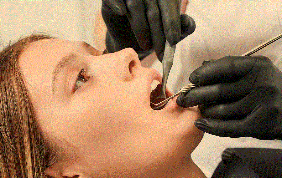 diş kökü iltihabı