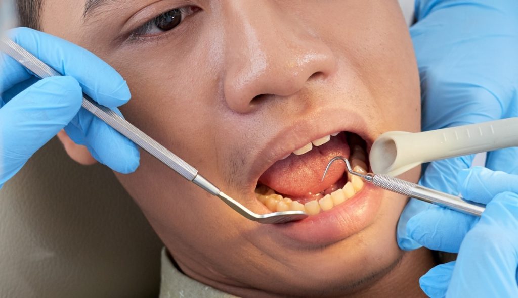 diş sızlaması neden olur