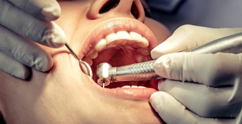 Kanal Tedavisi Yenileme