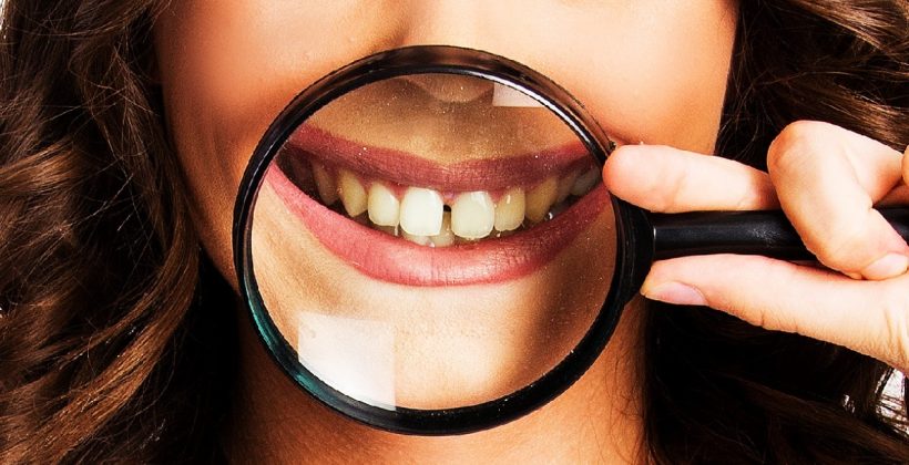 Ayrık Diş Tedavisi