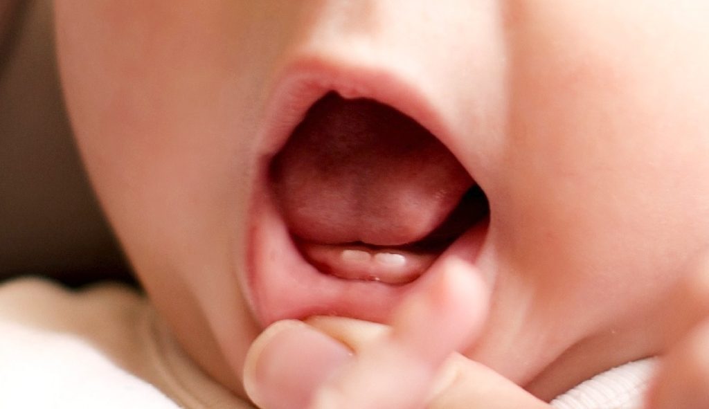 bebeklerde diş çıkarma