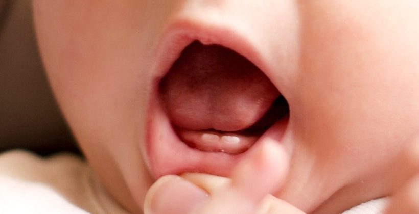 Bebeklerde Diş Çıkarma Belirtileri