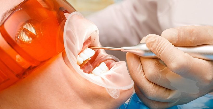 Diş Taşı Temizliği