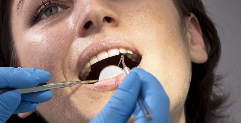 Diş Şeffaflaşması Diş Şeffaflaşması