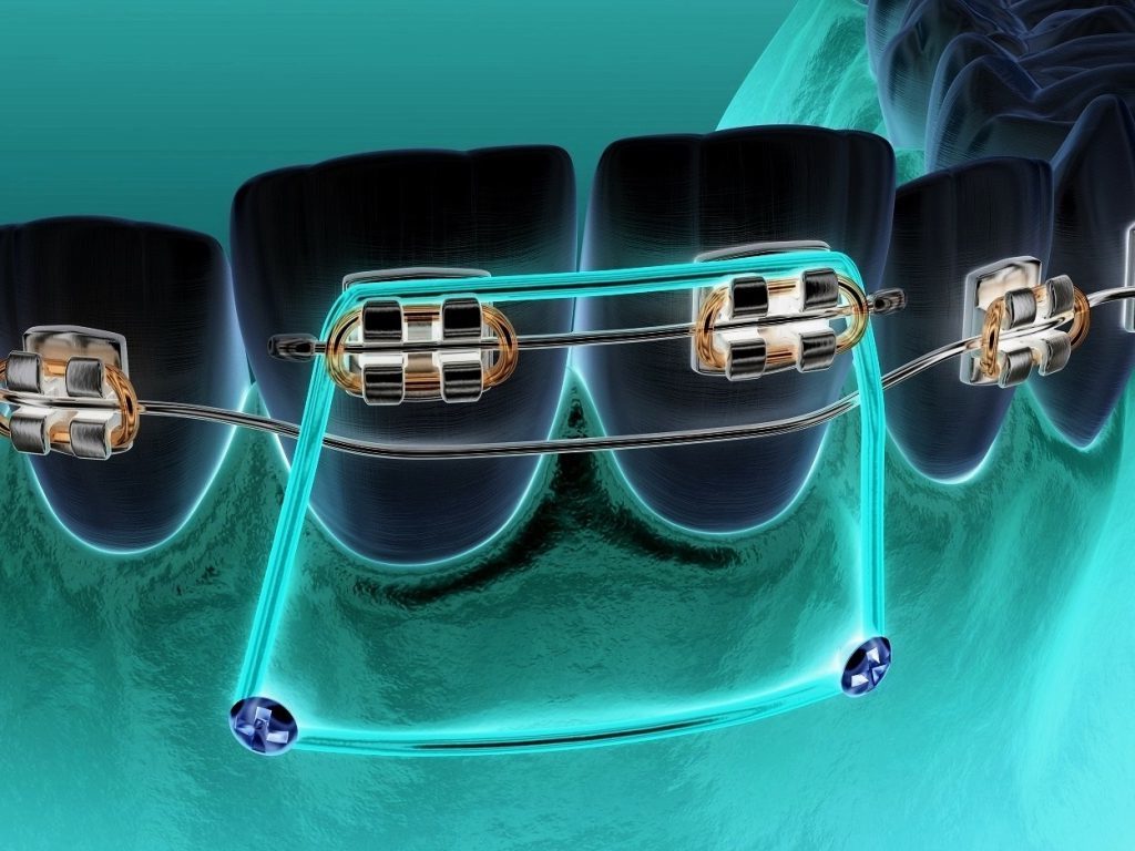 ortodonti tedavi fiyatları