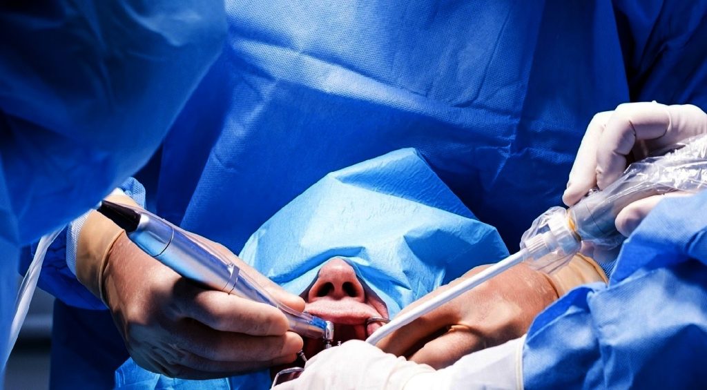 zigomatik implantların avantajları