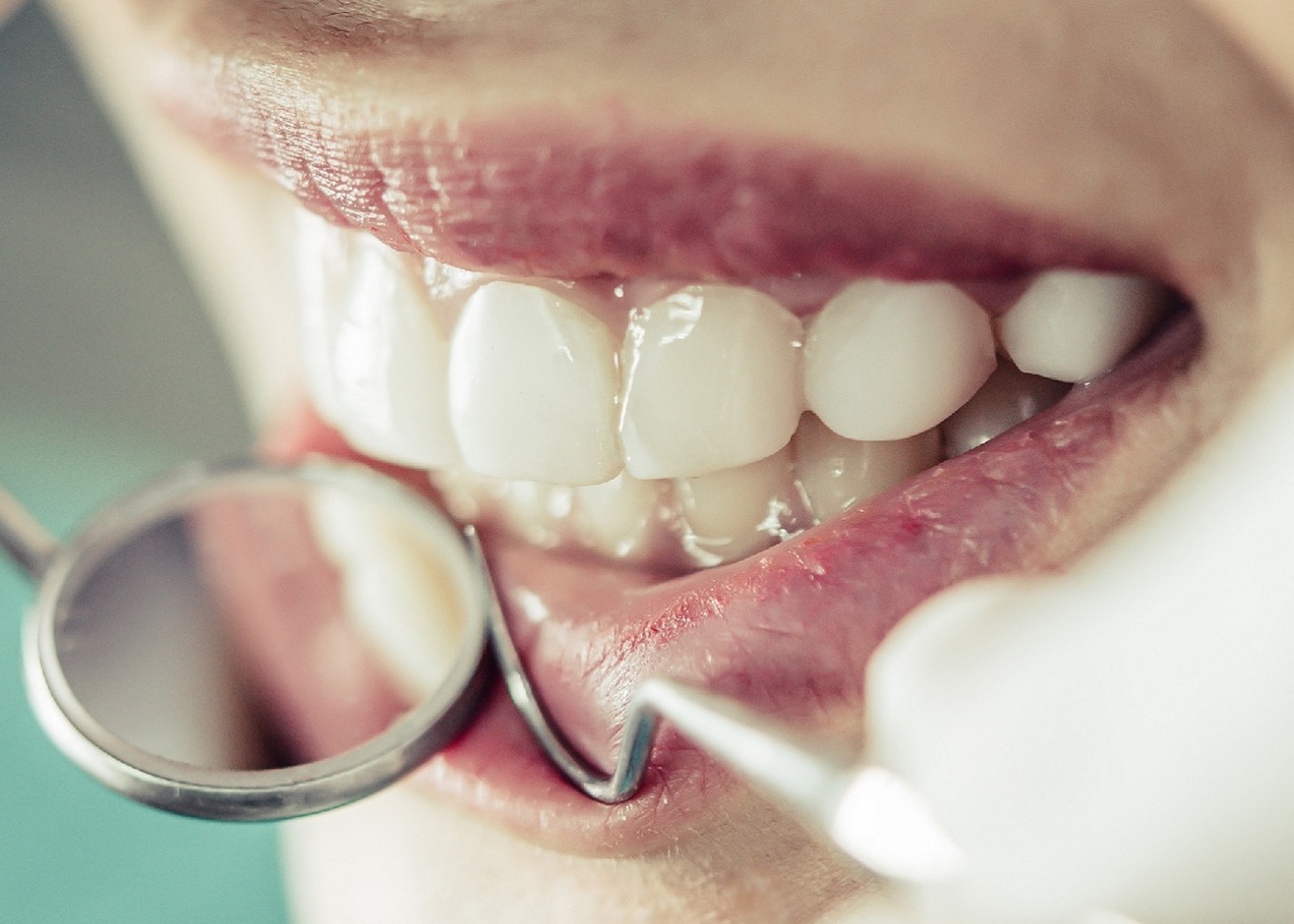 zirkonyum diş fiyatları