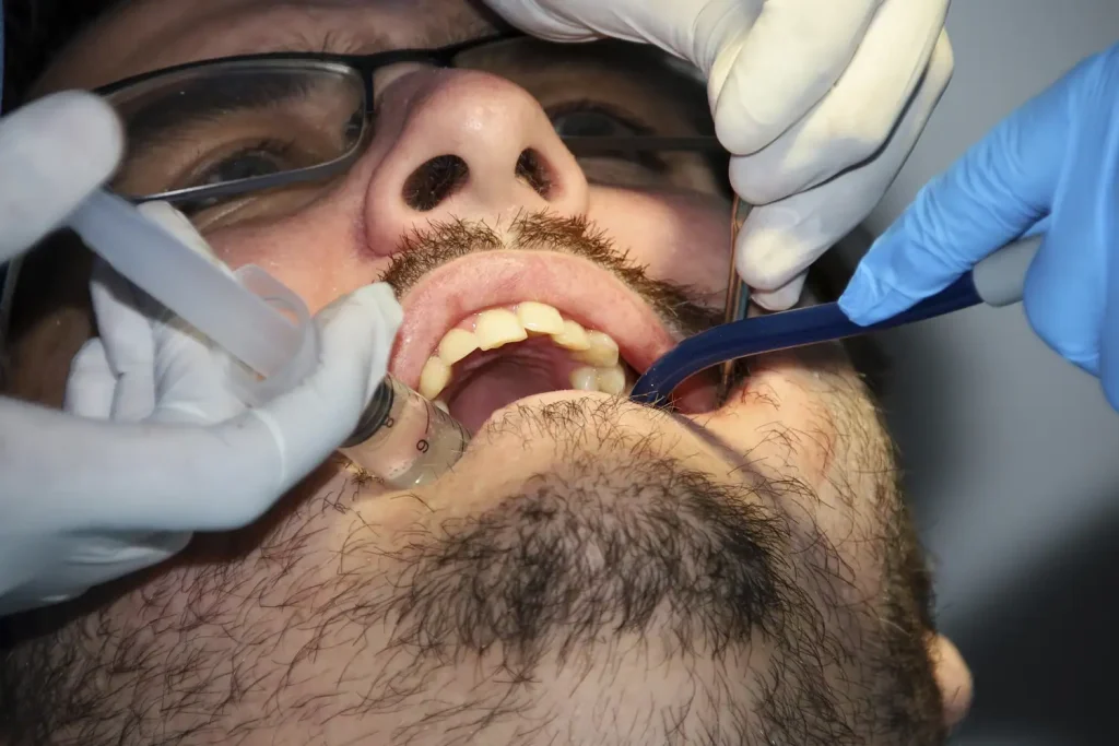 Apsenin En İyi ve Güvenli Tedavi Yöntemleri Nelerdir?