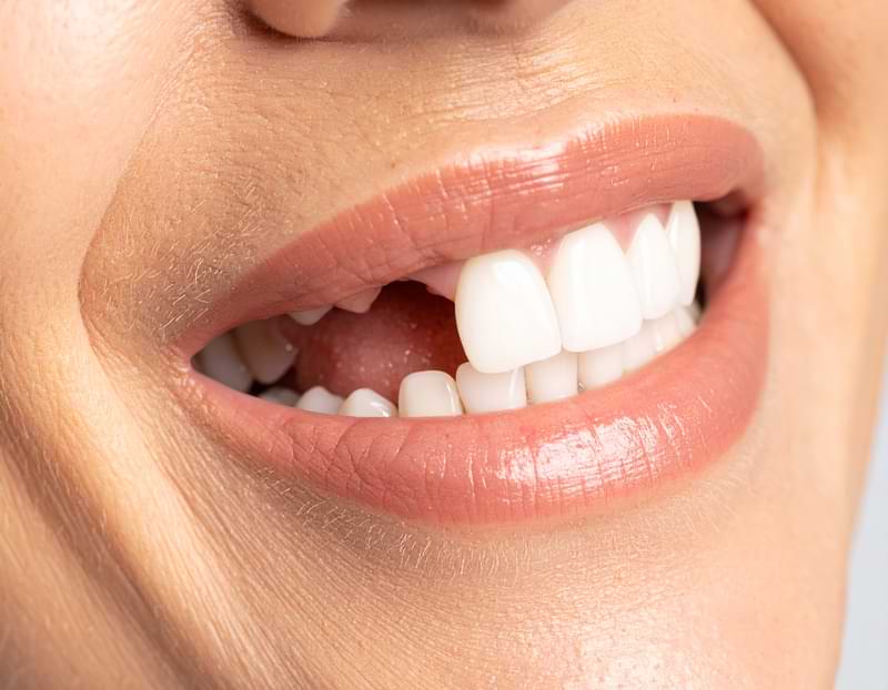 Diş Eksikliği Hangi Sorunlara Yol Açar