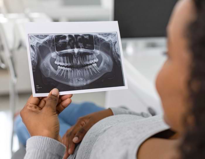 Hamilelikte diş röntgeni çektirmek zararlı mı